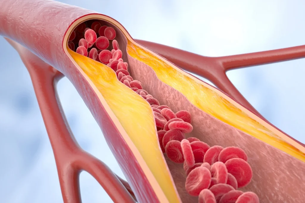 Médico vascular lista os melhores vegetais para a saúde das artérias