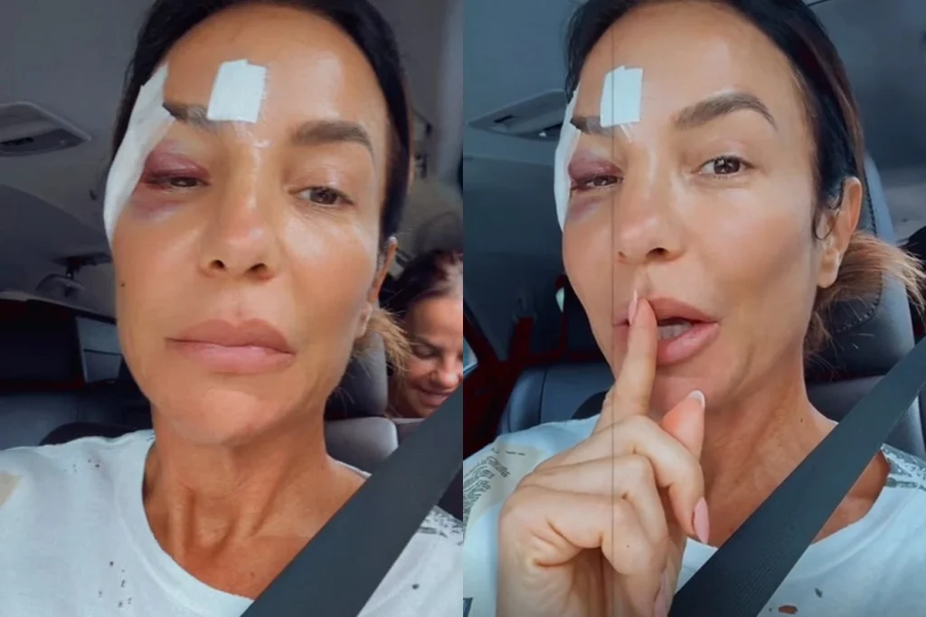 Ivete Sangalo agora fala sobre saúde após internação